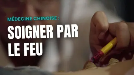 Soigner par le feu